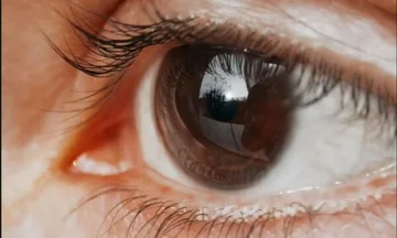 Simptoma pak e njohur e kancerit të syrit që shpesh ngatërrohet me diçka normale